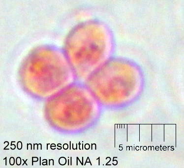 100x oil immersion objective with 250 nm resolution