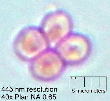40x objective with 445 nm resolution